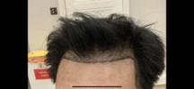 5A94496E-C80D-45EB-9336-8C26B2E518CB.png