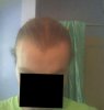 Frontal 2.jpg