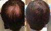 Month 1 vs Month 11.jpg