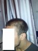 bild3blixt.jpg bild3blixt.jpg