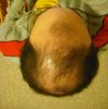before.jpg