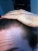 hairside2.jpg hairside2.jpg