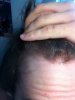 hairside.jpg hairside.jpg
