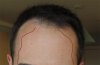 Spiro2_withlines.jpg Spiro2_withlines.jpg