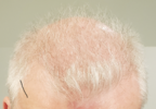 Month 2 - Nov 15 to Dec 15.png