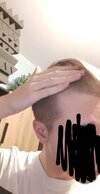 hairloss 4.jpg