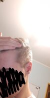 hairloss 3.jpg