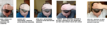 hairline2.png