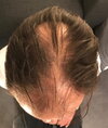 before - top.jpg