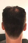 before- back.jpg