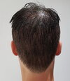 1 day after - back- wet.jpg