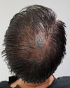 1 day after - crown - wet.jpg