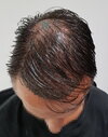 1 day after - top - wet.jpg