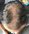 1 week after - top.jpg