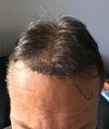 1 week after front.jpg