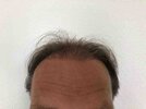 4 months after - front.jpg