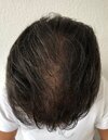 final result after 1 year top.jpg