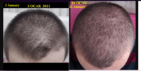 before.png