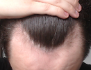 Hair.png