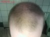 hairlognovember2.jpg
