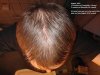 hairlogaug1.jpg