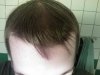 hairlogaug2.jpg