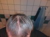 hairlogaug4.jpg