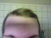 hairlogaug6.jpg