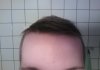 hairlogsep8.jpg