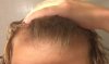 Hairline.JPG Hairline.JPG