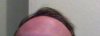 hair4.jpg hair4.jpg