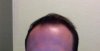 hair3.jpg hair3.jpg
