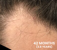 42-months.jpg