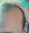 hairline.png hairline.png