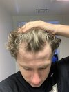 Aug. 2021 dry hairline.jpg