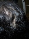 100_0148.JPG