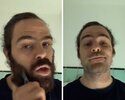 peter-lanzani-antes-despues.jpg_747478663.jpg