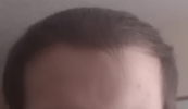 hairline.png hairline.png