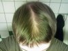 hairlog2014november2.jpg