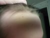 hairlog2014november6.jpg