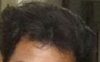 hairy 1.jpg hairy 1.jpg