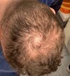 2-hair.JPG