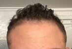 3-hair.JPG