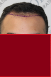 FIRST-1.png FIRST-1.png
