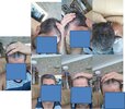 hairlos.jpg