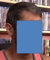 hairloss2.jpg