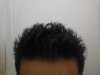 forehead.jpg forehead.jpg