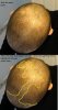 6 Current Hair Loss #1.jpg 6 Current Hair Loss #1.jpg