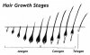 Hair_growth_stages_70132103.jpg Hair_growth_stages_70132103.jpg