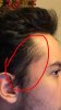 hair thin.jpg